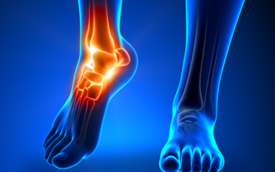 Will Ankle Pain Go Away on Its Own?